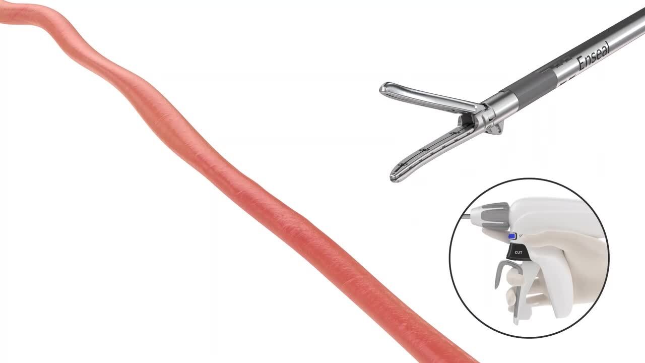 ENSEAL® X1 Curved In-Service Video
