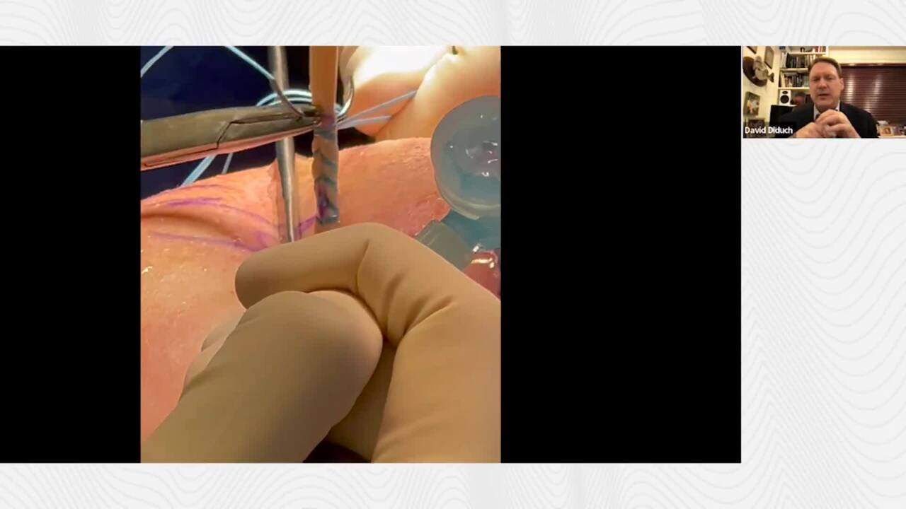 TIGHT-N Ink Technique Video