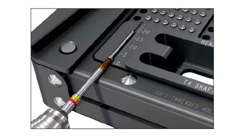 Variable Angle Locking Hand System cortex screw being attached to stardrive screwdriver shaft using screw recess