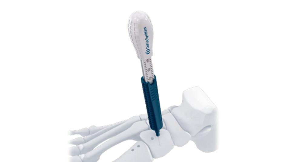 BME ELITE Depth Gauge used to determine depth of drill holes for hallux valgus deformity correction.