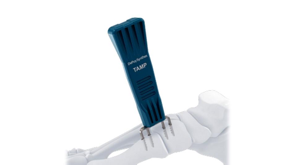 BME ELITE tamp used to seat implant for hallux valgus deformity correction.