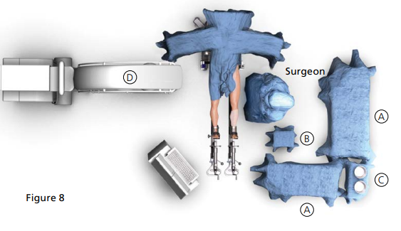 overhead diagram of room setup for the anterior advantage Matta method solution for anterior approach total hip replacement