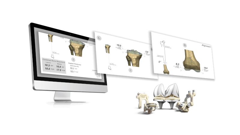 Computer monitor with TRUMATCH interface displayed next to a small grouping of knee implants