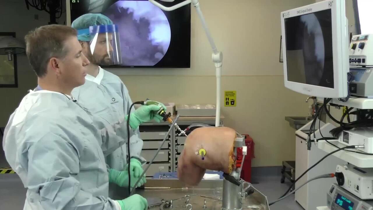 PCL Reconstruction w Achilles Allograft using TWISTR Retrograde Reamer and MILAGRO Advance Interference Screw Featuring Dr. Busconi