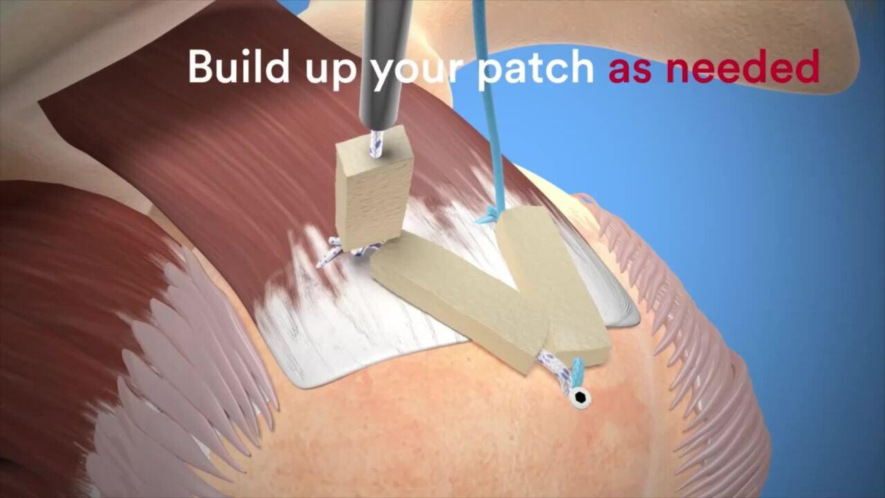 Dermis on Demand Promo Video 1