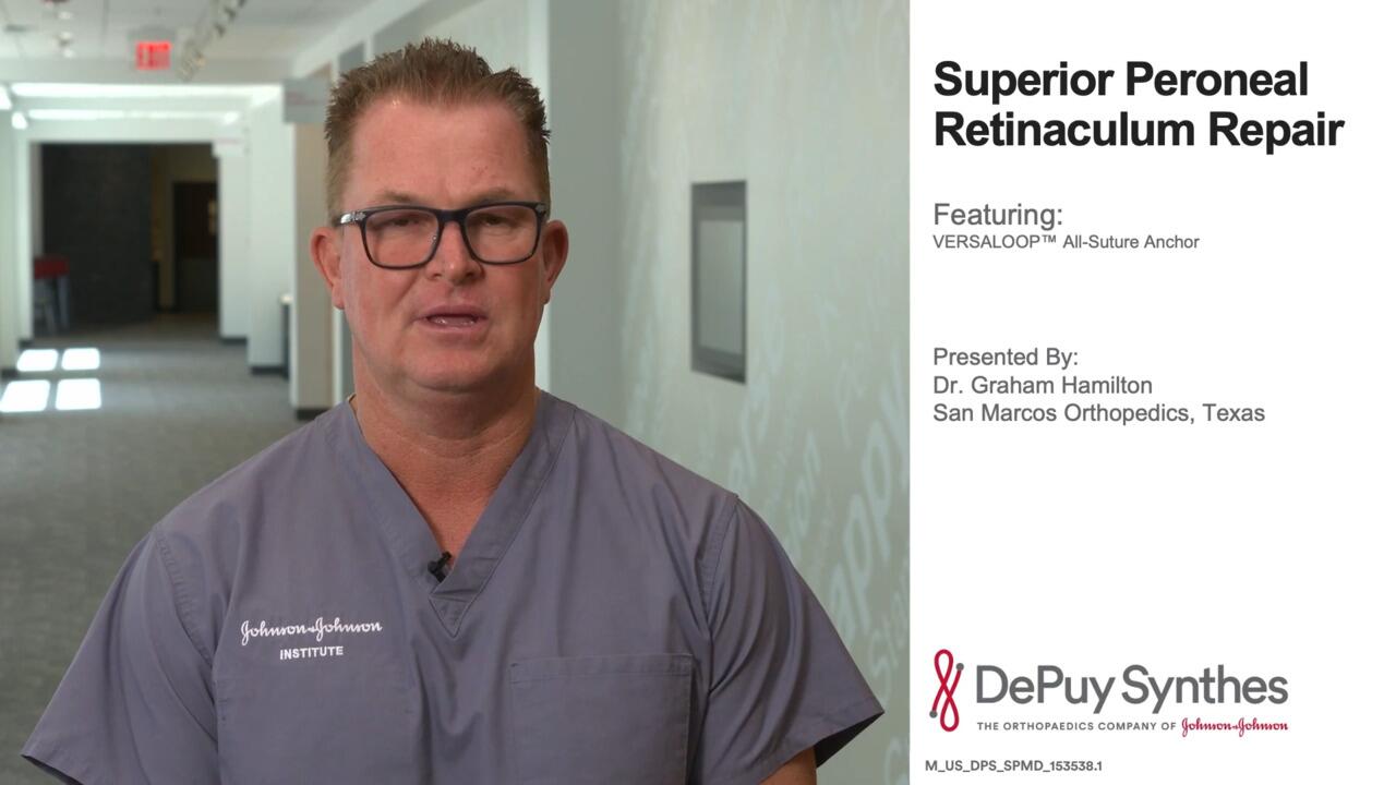 Superior Peroneal Retinaculum Repair Featuring Dr. Hamilton