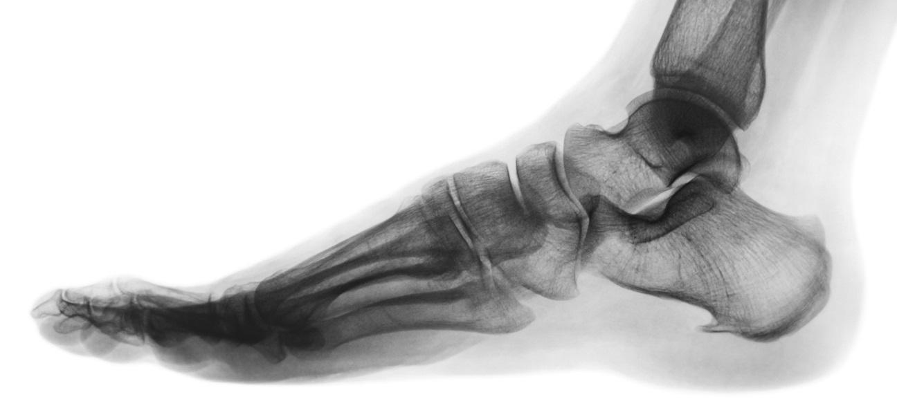 foot