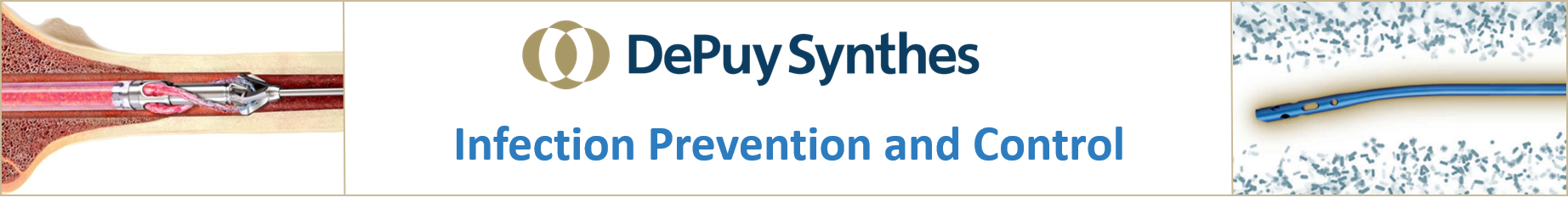 Contemporary Methods of Infection Prevention and Control in Orthopaedic Surgery