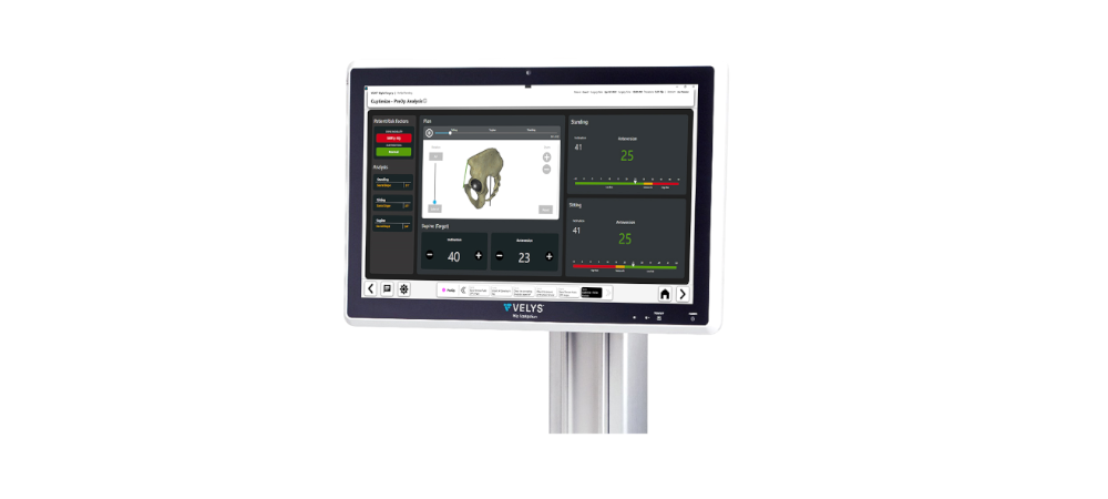 CUPTIMIZE Hip-Spine Analysis