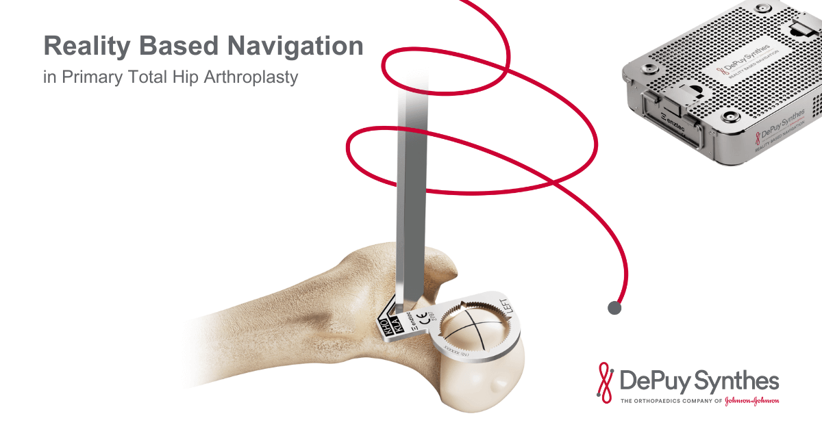 DePuy Synthes Rolls Out Reality Based Navigation