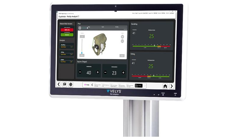 CUPTIMIZE Hip-Spine Analysis