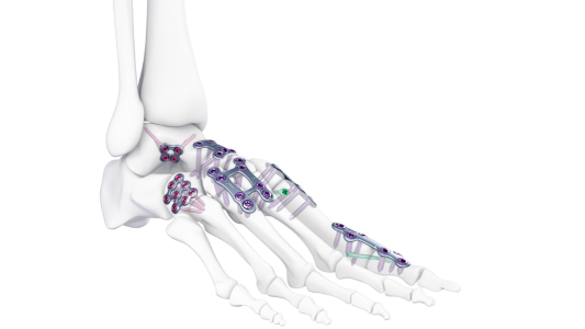plates on foot