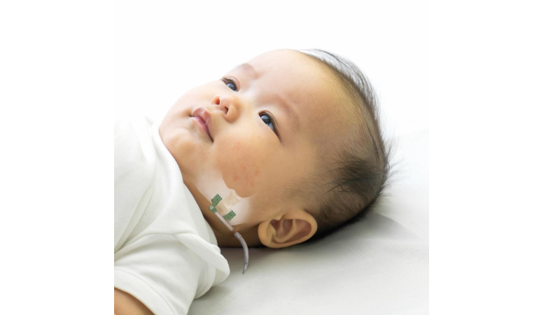 Craniomaxillofacial (CMF) Distraction System
